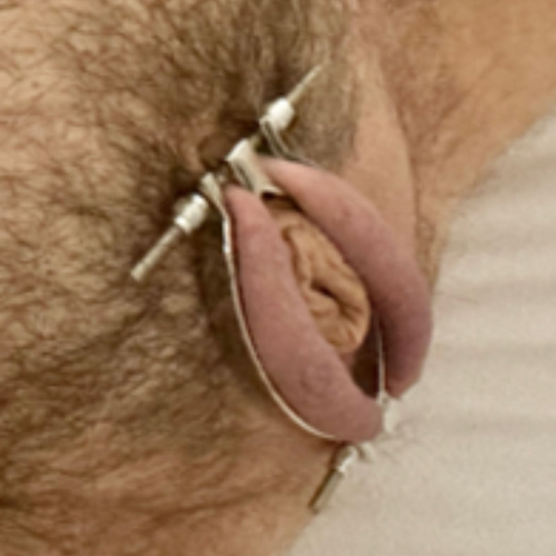 Feminization Labia Clamp/Spreader - Feminization - Twisted Jezebel